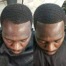 While african american men are least susceptible to male pattern baldness, hair loss still remains a major cause of concern for them. Fill In Thinning Hair With Ease Evolution Hair Fibers Human Hair Fiber For Men And Women Hair Loss Men Thin Hair Men Hair Fibers