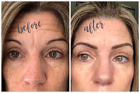 Eyebrow Microblading On Older Skin All You Need To Know Inside Outside Beyond A good microblading artist will give you natural.
