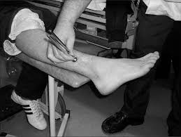 Image result for Tuning Fork Test