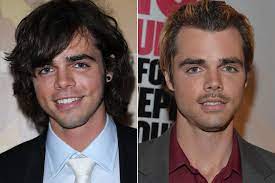 Modern Family Star Reveals Plastic Surgery Addiction Page Six