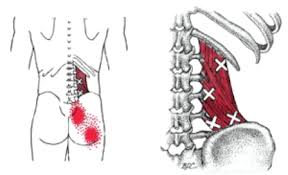 What You Need To Know About Muscle Knots Or Trigger Points Healing Art Community Quadratus Lumborum Stretch Muscle Knots Dry Needling Therapy