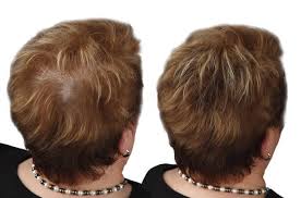Auch bereit für eine neue frisur oder neues styling? Vorher Nachher Bilder Super Million Hair