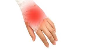 Skaden førte til mange store brudd i røra. Handrotsbrudd Nhi No