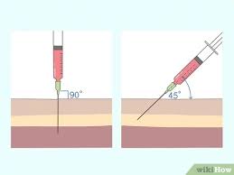 It's likely that you'll need to know how to give a dog an injection at some time or another. How To Give A B12 Injection 15 Steps With Pictures Wikihow
