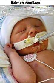 premature apnesi dr bulent aldemir