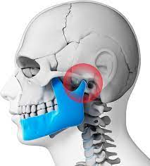 See full list on mayoclinic.org Tmj Treatment Red Bank Nj Monmouth County New Jersey
