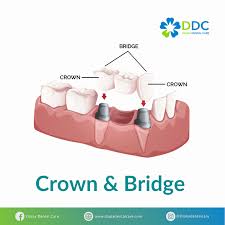 Check spelling or type a new query. Layanan Diana Dental Care