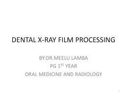 Dental X Ray Film Processing