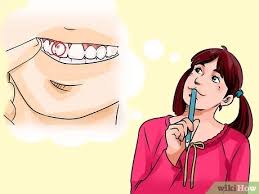 No matter the reason for your cavity, it's essential to get it taken care of before the problems. 3 Ways To Know If You Have A Cavity Wikihow