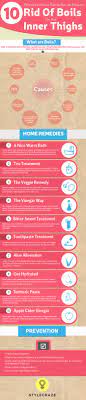 Boils on inner thighs is one of the most common problems one faces. How To Get Rid Of Boils On The Inner Thighs Visual Ly