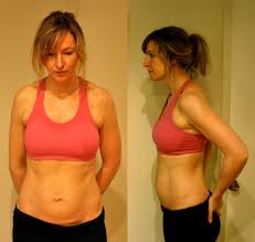 We did not find results for: Diastasis Recti A Case Of Mommy Tummy Today S Parent