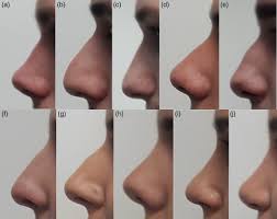 Check spelling or type a new query. What Do We Find Attractive About The Face Survey Study With Application To Aesthetic Surgery Vucinic 2020 Clinical Anatomy Wiley Online Library
