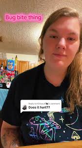 Bug Bite Relief Tips You Need to Know