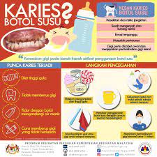Menurut dr iqbal rosali, seorang pegawai. Kenali Karies Botol Susu Perpustakaandesa Batulaut Facebook