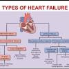 Heart failure is a condition where your heart muscle doesn't pump blood as well as it should. 1