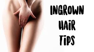 The problem of ingrown hair is very common in men and women. 5 Tips To Prevent Ingrown Hairs After Brazilian Wax Olivia Frescura Youtube