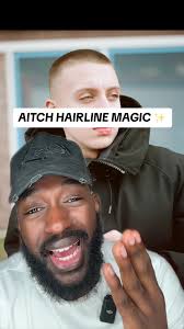 Aitch's Incredible Hairline Transformation Revealed