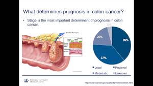 Introduction to cancer symptoms and signs. Colon And Rectal Cancer How Much Of A Problem Is It Really Youtube
