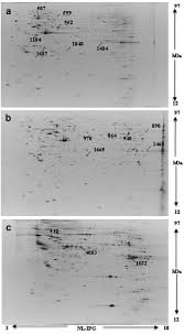 Check spelling or type a new query. Putative Biomarkers For Malignant Pleural Mesothelioma Suggested By Proteomic Analysis Of Cell Secretome Cancer Genomics Proteomics