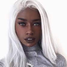 Meyong Ig Melvnin Gambian White Hair Dark Skin White Lips