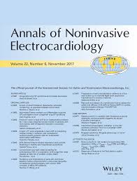 I'm applying for another scribe position. Ecg Derived Cheyne Stokes Respiration And Periodic Breathing In Healthy And Hospitalized Populations Tinoco 2017 Annals Of Noninvasive Electrocardiology Wiley Online Library