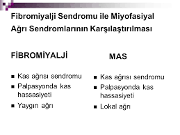 Miyofasiyal ağrı sendromunun nedeni nedir? Yumusak Doku Romatizmalari Ppt Video Online Indir