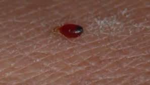 Bed bugs are the size of a poppy seed when they hatch from eggs. Do Baby Bed Bugs Bite