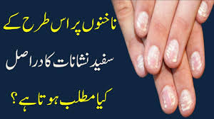 What Vitamin Deficiency Causes White Spots On Your Nails Raaztv You Nailed It White Spot Spot On