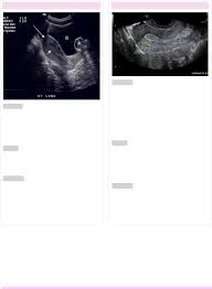 Grátis: GO imaginologia COMPLETO - Material Claro e Objetivo em PDF para  Estudo Rápido