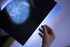 This test can help show if the cancer has spread to your bones. How Fast Can Breast Cancer Spread In 1 Year
