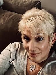 Face 2 Face Friday! Got a new hair cut to help my hair not look so thin. My  hair was thinking before surgery so I can't tell if it's thing more or