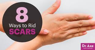 Treating scar tissue is not easy. How To Get Rid Of Scars Naturally 8 Remedies Dr Axe