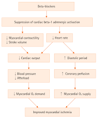 Image result for Myocardial Infarction Stabilization