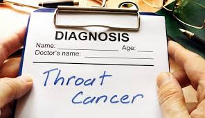 I had an on and off sore throat and hoarseness for many many months, but was a smoker. Throat Cancer Treatment How It S Changing Md Anderson Cancer Center