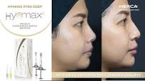 Hyamax®Extra Deep for nose filler
