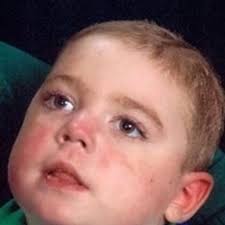 Thomas Mark Alberts Obituary October 17, 2015