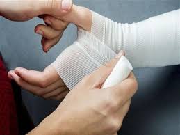 متى تستدعي إصابات اليد زيارة الطبيب مصراوى