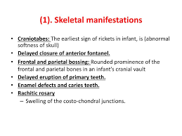 Image result for Craniotabes