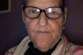 Fundraiser by Carol Burke : Annie needs help.