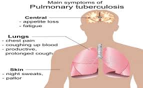 Thoracentesis may be performed for diagnosis or therapy. Pulmonary Tuberculosis Disease Causes And Nursing Intervention