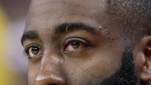 James harden was able to come back into the game. Harden Still Dealing With Eye Injury Will Play In Game 3 Abc News