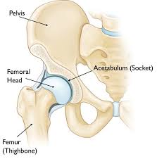 You're having issues with your mental health. Total Hip Replacement Orthoinfo Aaos