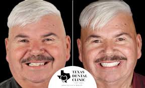 Texas Dental Clinic