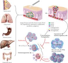 E) none of the answers are correct; Current Status Of Immune Checkpoint Inhibition In Early Stage Nsclc Annals Of Oncology
