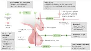 Image result for Hyperprolactinemia