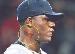 한편, 이승엽은 지난 2002년 이송정과 결혼했다. ëˆì í•œ ì‹œëŒ€ ëì¸ê°€ Mlb íŒŒì¸íƒ€ë¥´ ê·œì œ ë„¤ì´íŠ¸ë‰´ìŠ¤