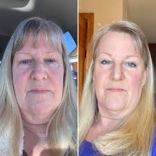 Before and after hair color transformation