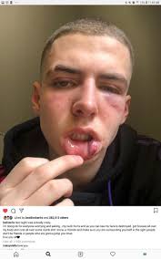 Larray then turns to charles' side by dissing charles's rival tati westbrook as he refers to their drama with tati forty and complaining about some vitamins. Green Leaf City News Auf Twitter Bryce Hall Took To Instagram Live 2 Days Ago And Address The Problem From There Youtube The Tea