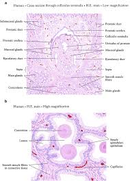 Normal prostate prostate cancer histology. Seminal Vesicle Penis And Urethra Radiology Key