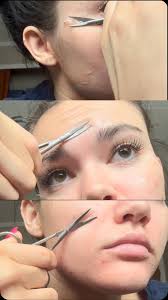 ✨The Importance of NOT pulling off the skin after a chemical peel✨, As  tempting as it can be to pull off the flaking skin once your skin starts to  peel, DO NOT do it! If you peel off the skin before ...